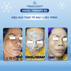 Liệu trình oxy chống ô nhiễm đô thị Thanh lọc và tái tạo da excel therapy o2