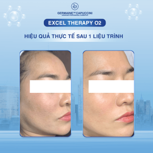 Liệu trình oxy chống ô nhiễm đô thị Thanh lọc và tái tạo da excel therapy o2