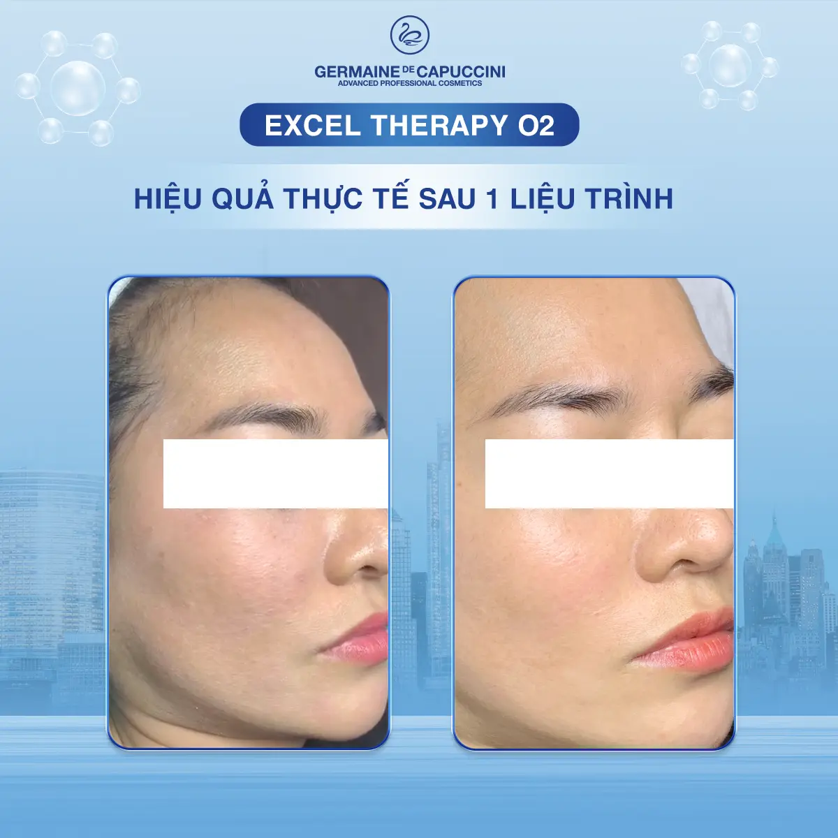 Kết quả thực tế sau một liệu trình Excel Therapy O₂ - hình 4